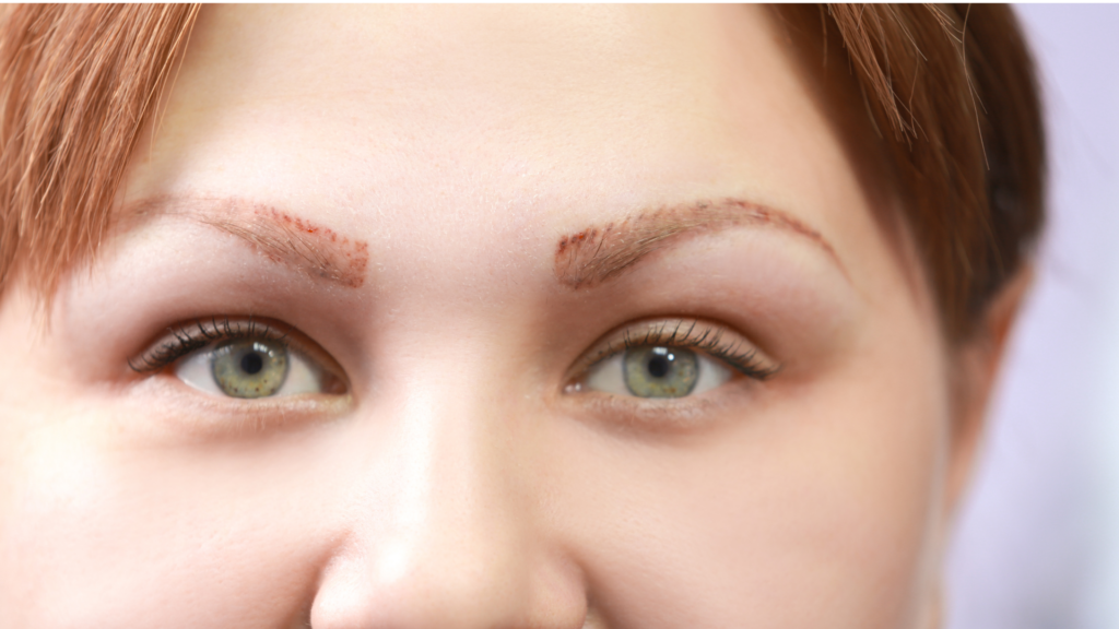 Tattoo Corrections & Removals